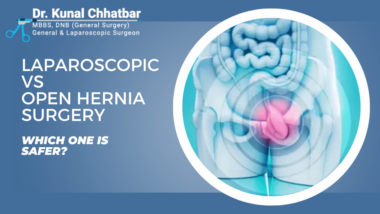 Laparoscopic vs Open Hernia Surgery